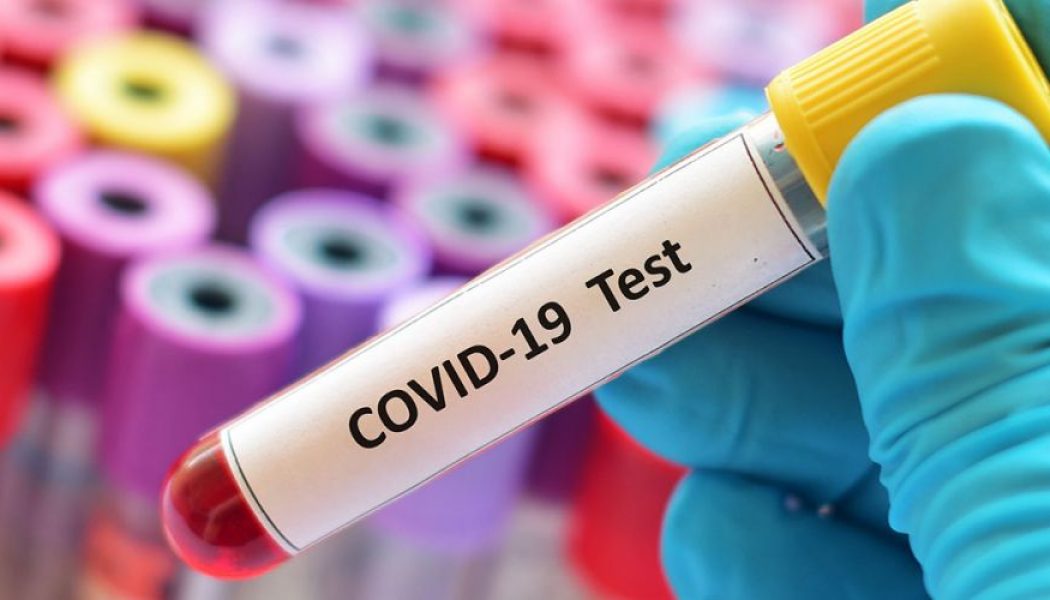 Nuovi casi di Covid a Braidi