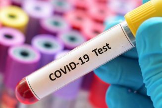 Nuovi casi di Covid a Braidi